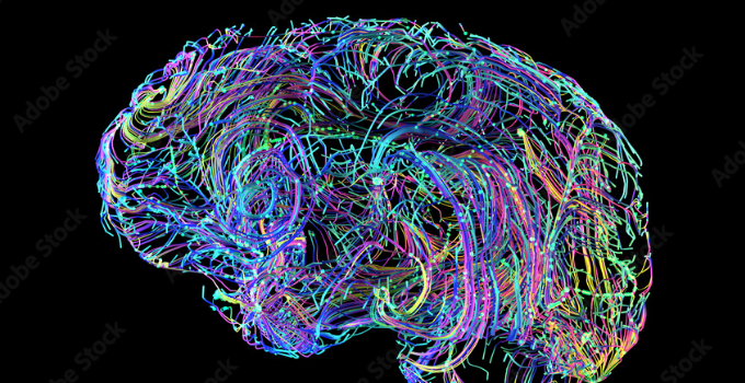 3D rendering of a brain