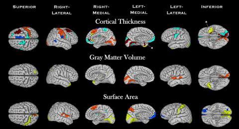 Figure 4 from the article title.  In the figure, hubs are shown in red for FEAP, yellow for HC, light blue for schizophrenia, and dark blue for non-schizophrenia for cortical thickness (top), gray matter volume (middle), and surface area (bottom) SCNs. Gray areas are not defined as hubs for any group and dark red areas are overlapping between groups. *signifies the hubs overlapping between HC and NSZ and all other hubs that overlap are between FEAP and NSZ.